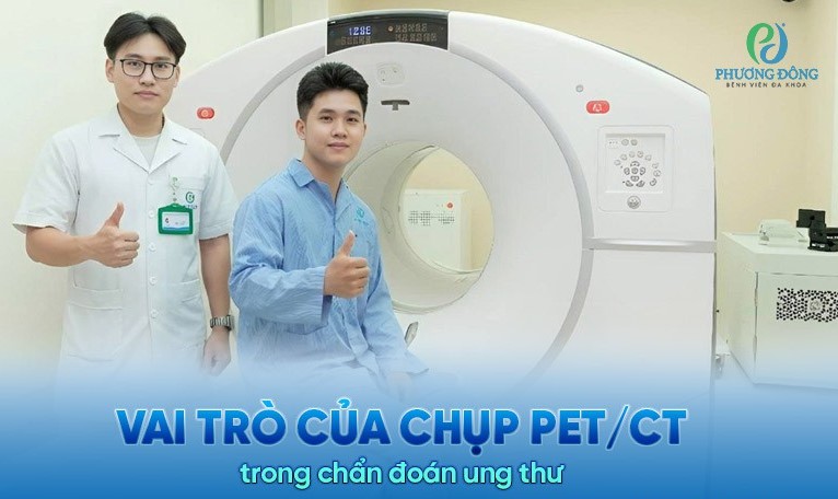 vai-tro-cua-chup-pet-ct-trong-chan-doan-ung-thu-5