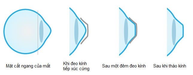 cơ chế orthok