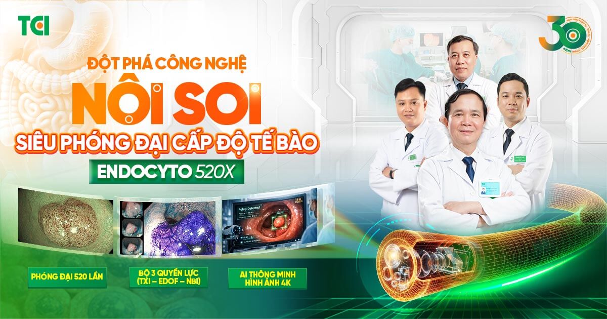 noi-soi-tieu-hoa-endocyto