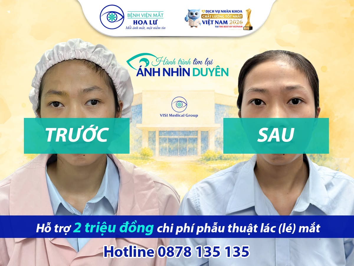 “MẮT EM THỈNH THOẢNG MỚI LỆCH, NÊN TRƯỚC ĐÂY EM CŨNG KHÔNG NGHĨ NHIỀU…”- CÔ GÁI 24 TUỔI QUYẾT ĐỊNH TÌM LẠI ÁNH NHÌN TỰ TIN