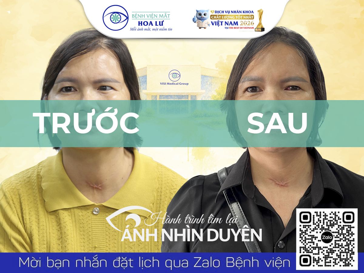 PHẪU THUẬT LÁC – ĐIỀU CHỊ MẦU CHỜ ĐỢI SAU 2 NĂM KỂ TỪ TAI NẠN