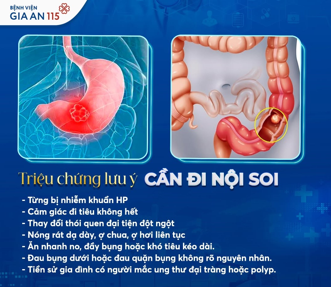 noi-soi-tieu-hoa-benh-vien-gia-an-115