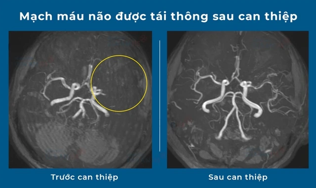 bscki-phan-ngoc-thao-2